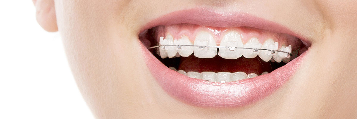 Claremont Invisible Orthodontics