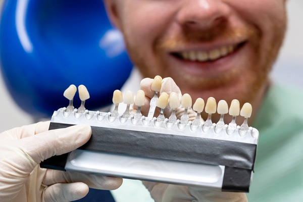 When To Consider Dental Veneers