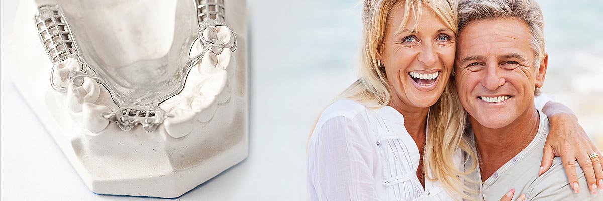 Claremont Implant Supported Dentures