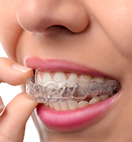 Clear Aligners - Almost Invisible Braces Claremont, CA