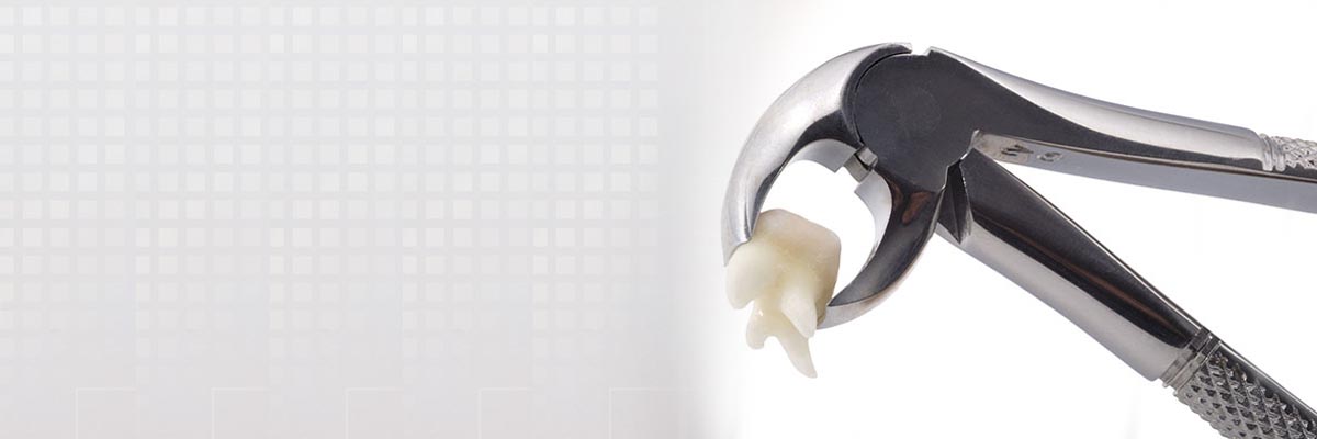 Claremont Tooth Extraction